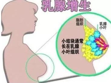 鹿角帽粉對乳腺增生有效嗎